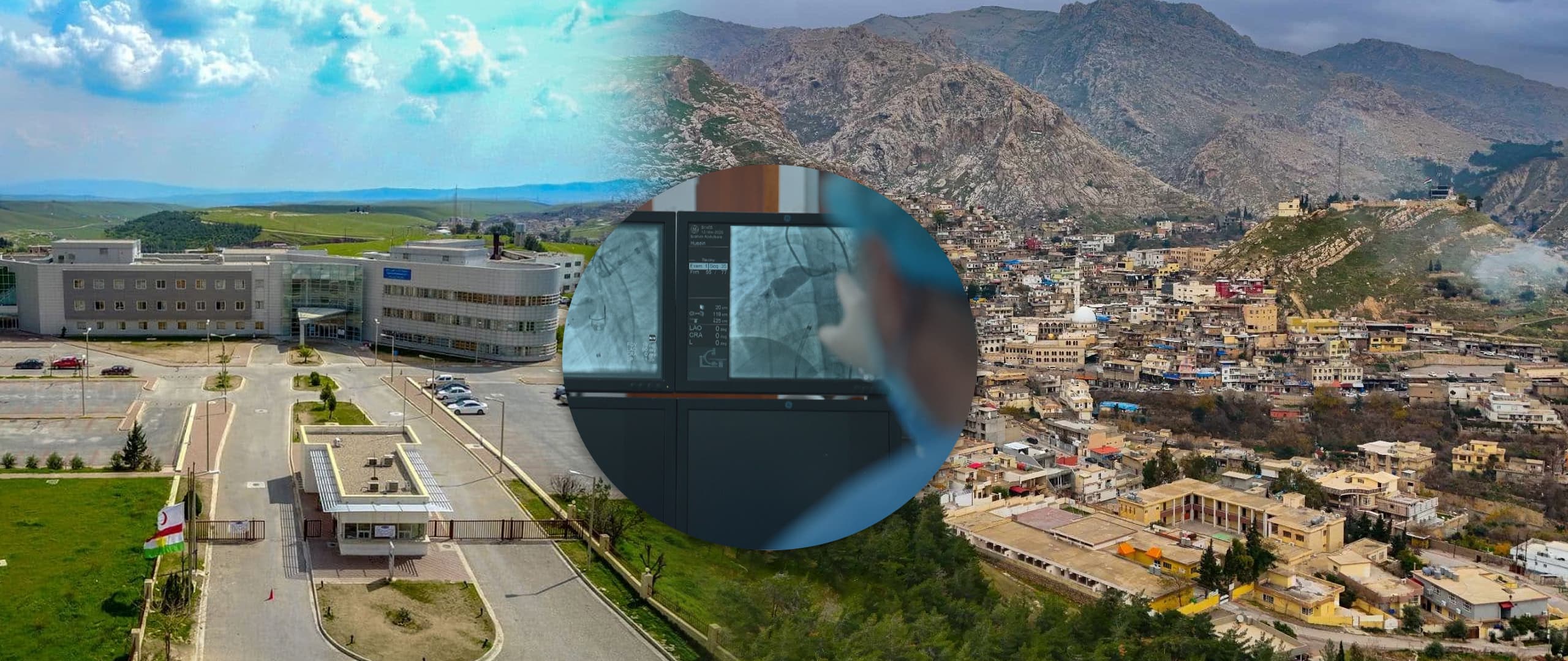 تەندروستیی ئاکرێ: پێویستمان بە یەکەی قەستەرەی دڵ هەیە