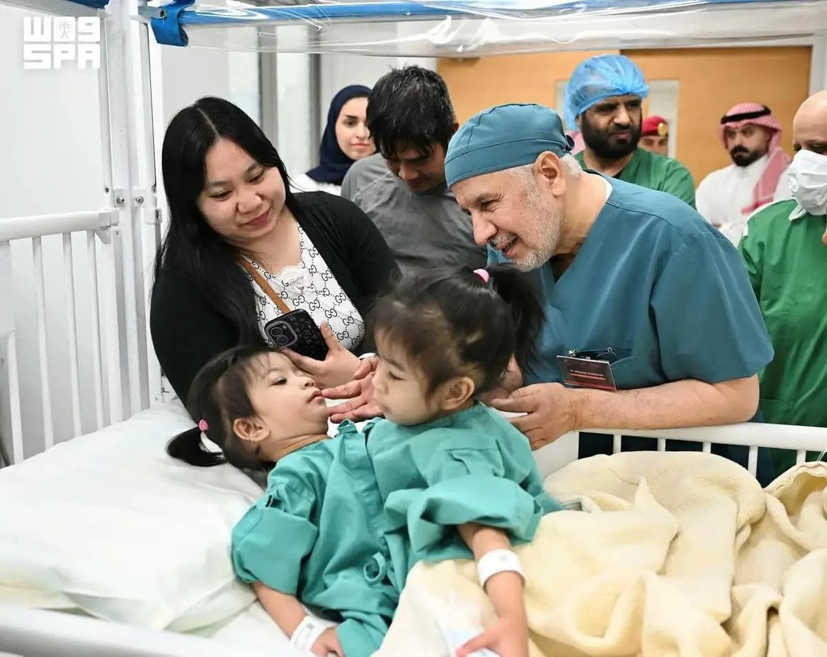 لە سعودیە دووانەیەکی بەیەکەوەلکاو لە یەکدی جیا کرانەوە