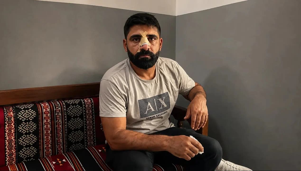 Bayburt’ta Amedspor formasıyla saldırıya uğrayan işçi, AK Parti milletvekilinin akrabası çıktı