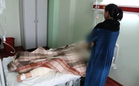 A young Kurdish girl, Maryam Nebil, 14, is being treated for sever burning injuries after she set her-self on fire, June 1, 2013. Photo courtesy of BBC UK.