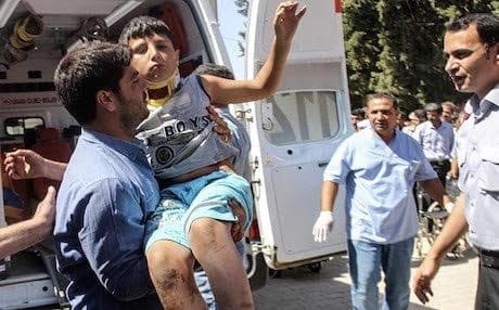 A child wounded in the Kobani attacks. AFP photo. 