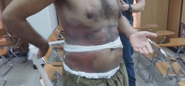 Peshmerga forces were examined by international investigators. Rudaw photo.