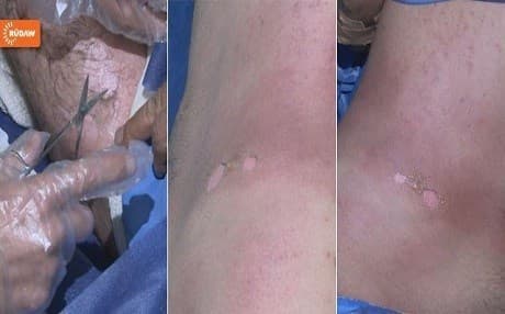  35 Kurdish Peshmerga soldiers became ill after being exposed to the gas.