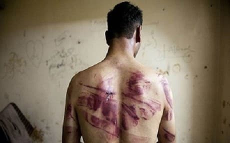 A former Syrian detainee and torture victim. AFP file photo.