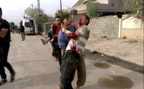 A man carries a boy wounded by an ISIS mortar attack in a neighborhood in eastern Mosul in November as captured by Rudaw cameras.