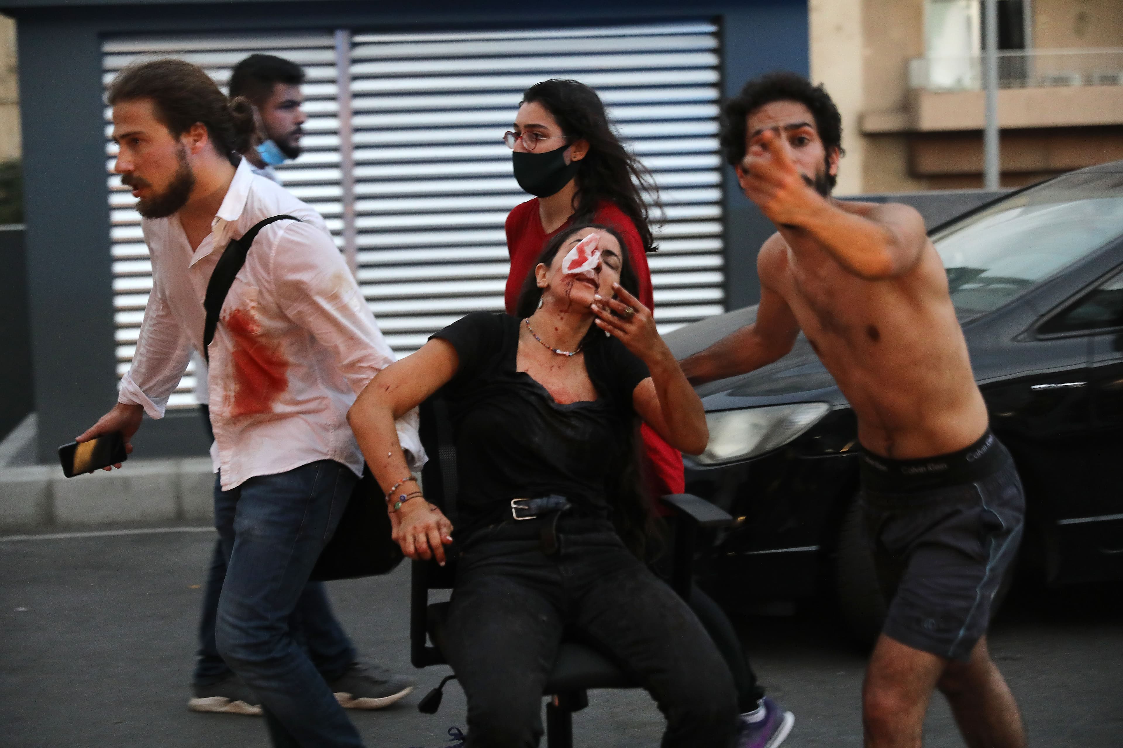Wounded people are pictured outside a hospital following an explosion in the Lebanese capital Beirut on August 4, 2020. Photo: Ibrahim Amro / AFP