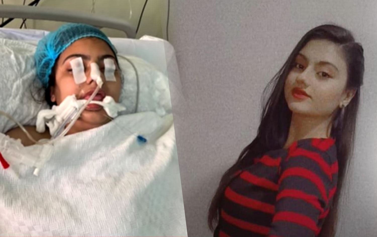 Ayjan after and before the incident. Photos submitted: by Aijan's family