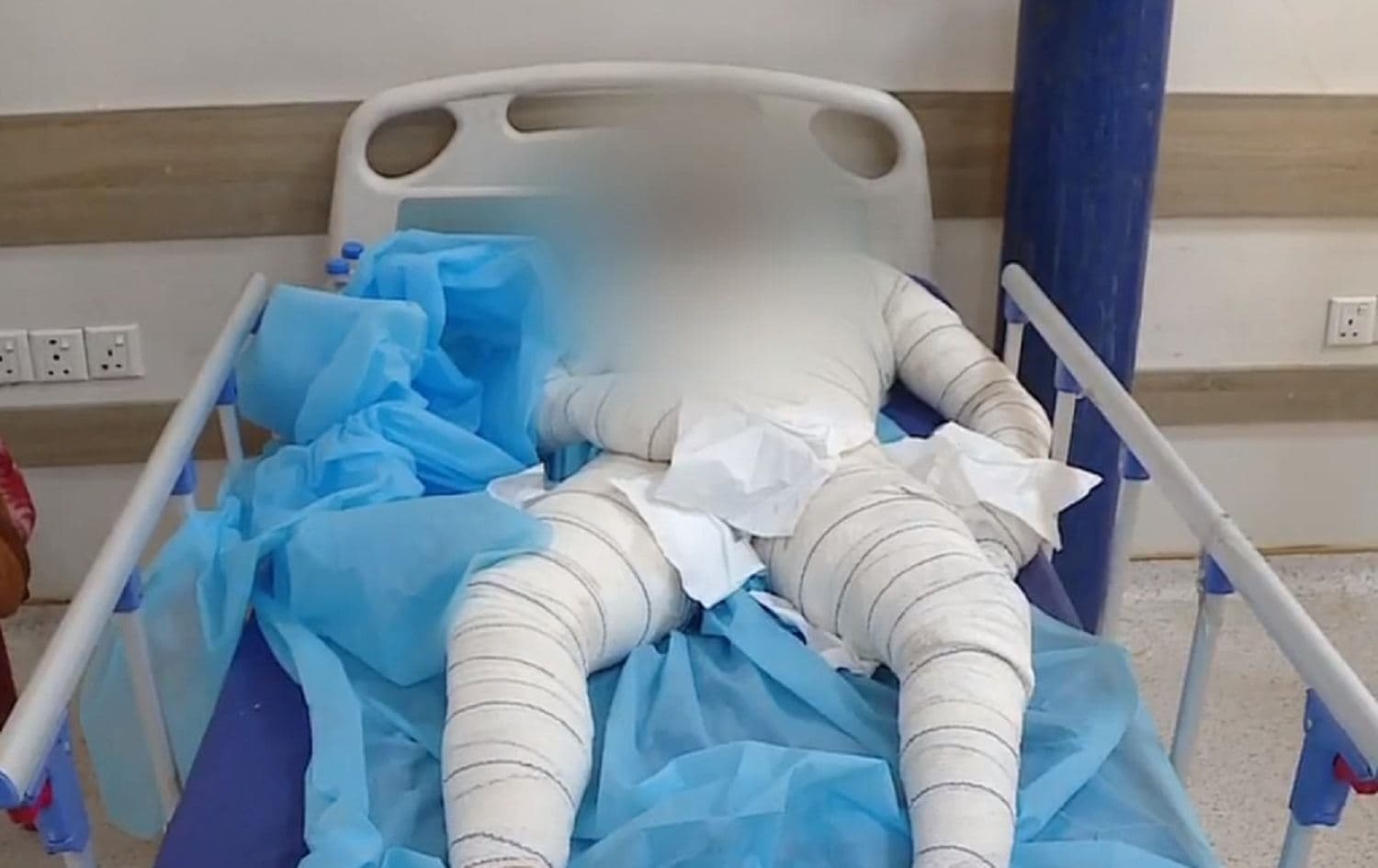 Behzad Mahmoudi lies in a hospital bed after setting himself on fire in protest in front of the UNHCR office in Erbil on May 18, 2021. Photo: Rudaw