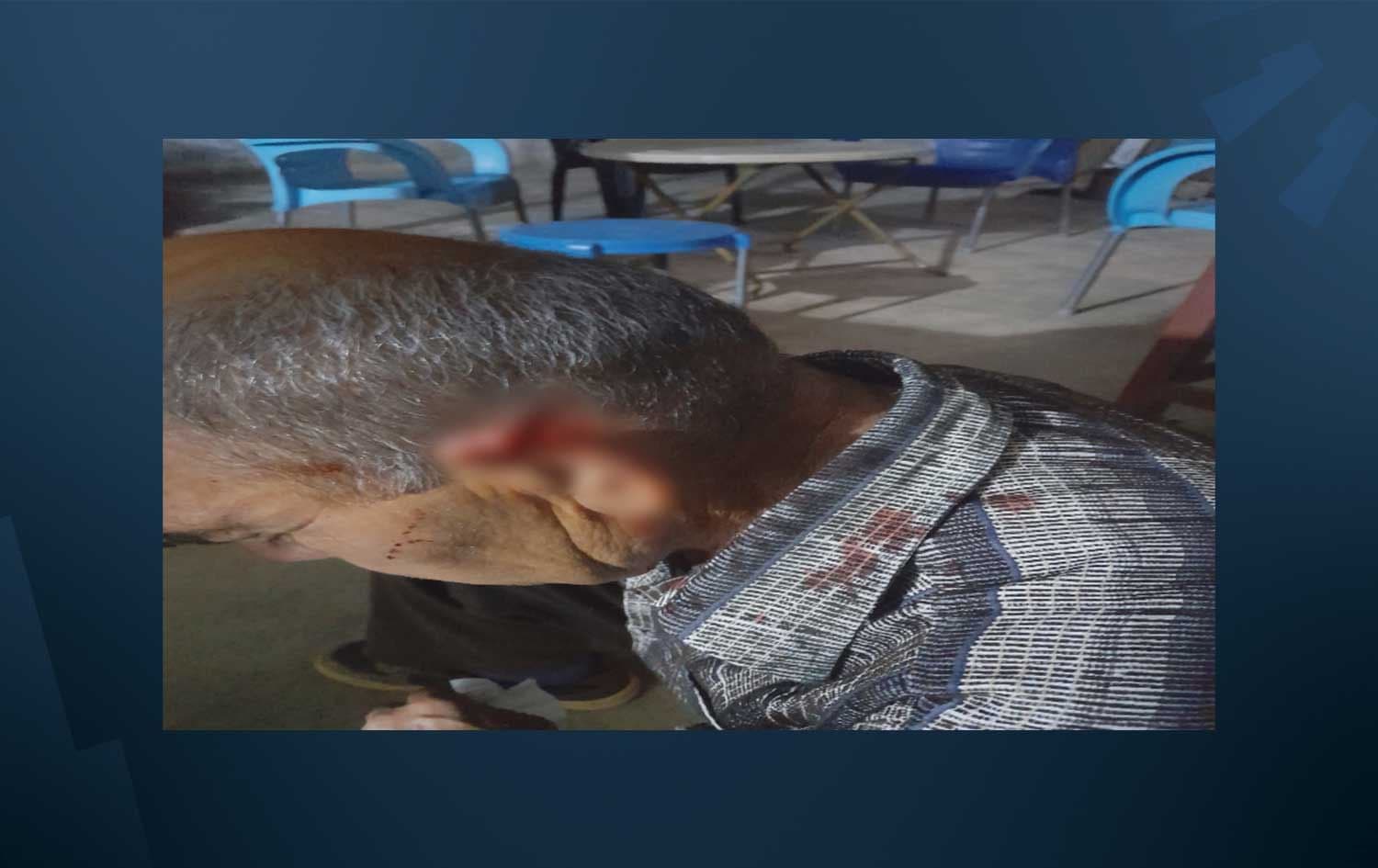 Wêneyê pîremêrê Kurd Kemal Hesen Menan ê ji nahyeya Raco ya Efrînê ku çekdaran ew îşkence kirine. Wêne û grafîk: Rûdaw