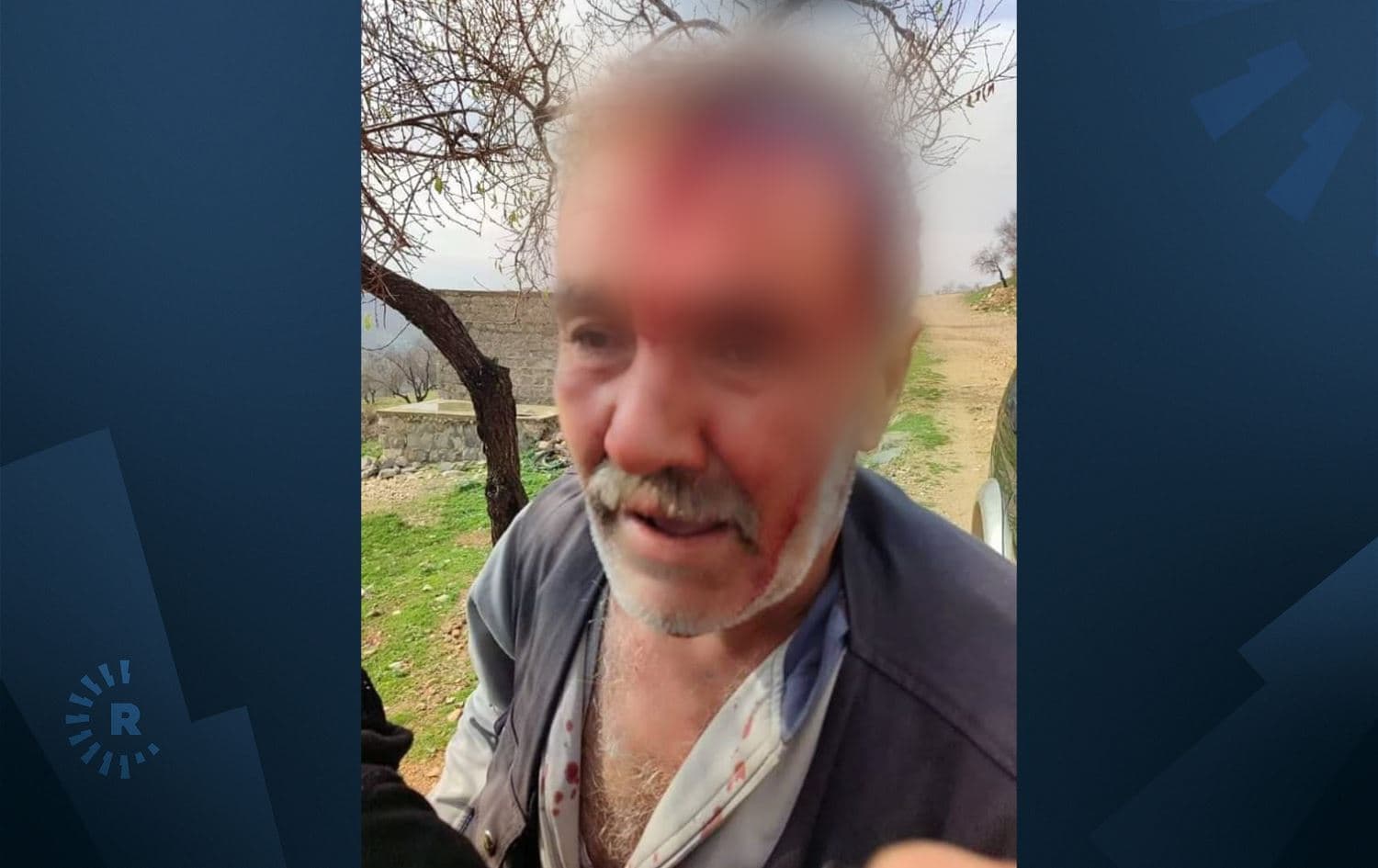 Ahmad Alu, a local of Afrin's Barkasha village, after being assaulted by resettled Arab shepherds in the area on January 21, 2024. Photo: Afrin Human Rights Organization