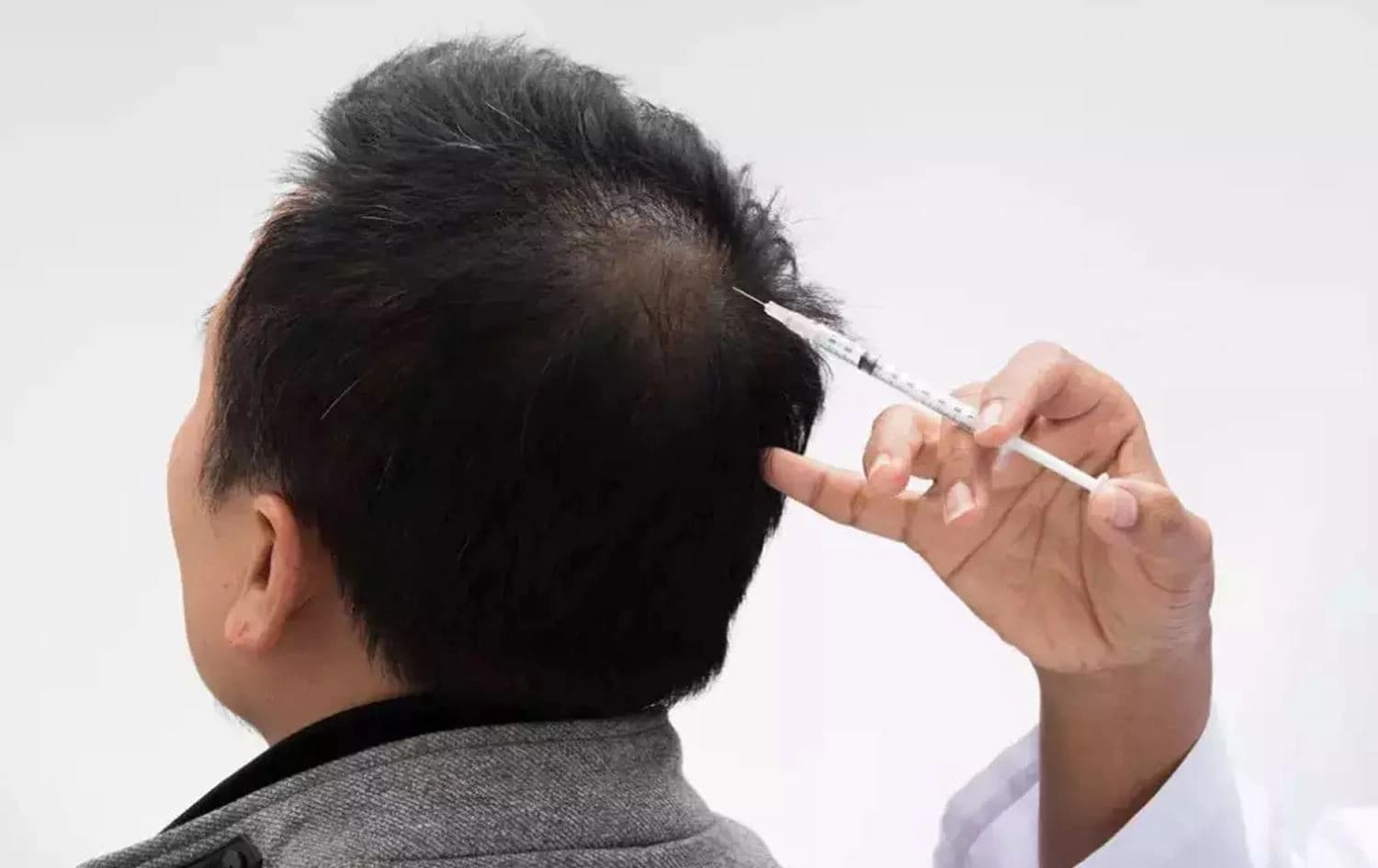 دەرزییەک لە پێستی دەر دەدرێت. وێنە: ScienceAlert