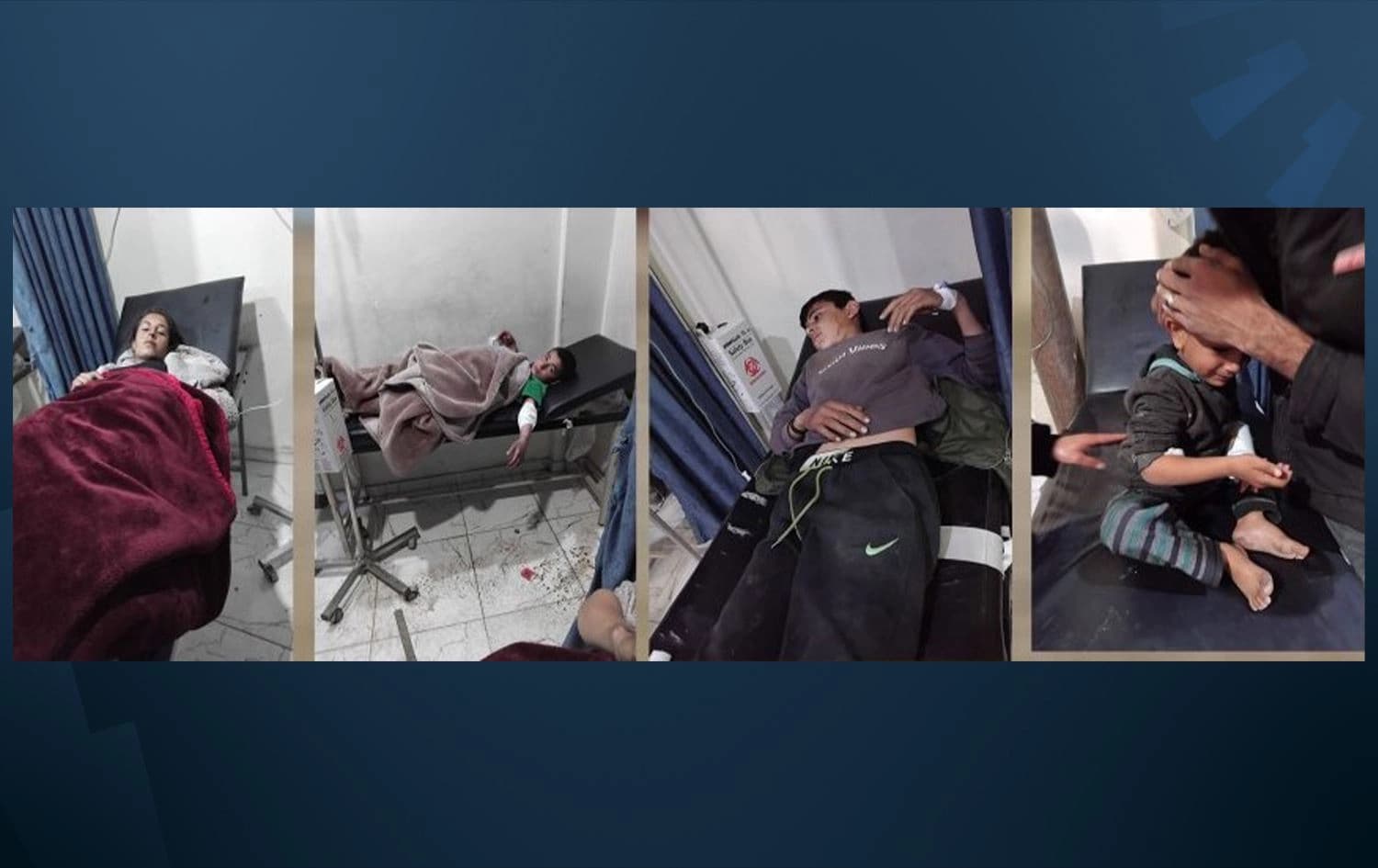 Zarokên ku di bombebaranê de birîndar bûne/Wêne: ANHA
