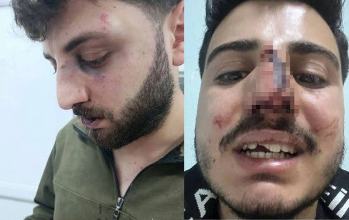 Van’da polisten kardeşlere darp iddiası: Soruşturma jandarmaya devredildi