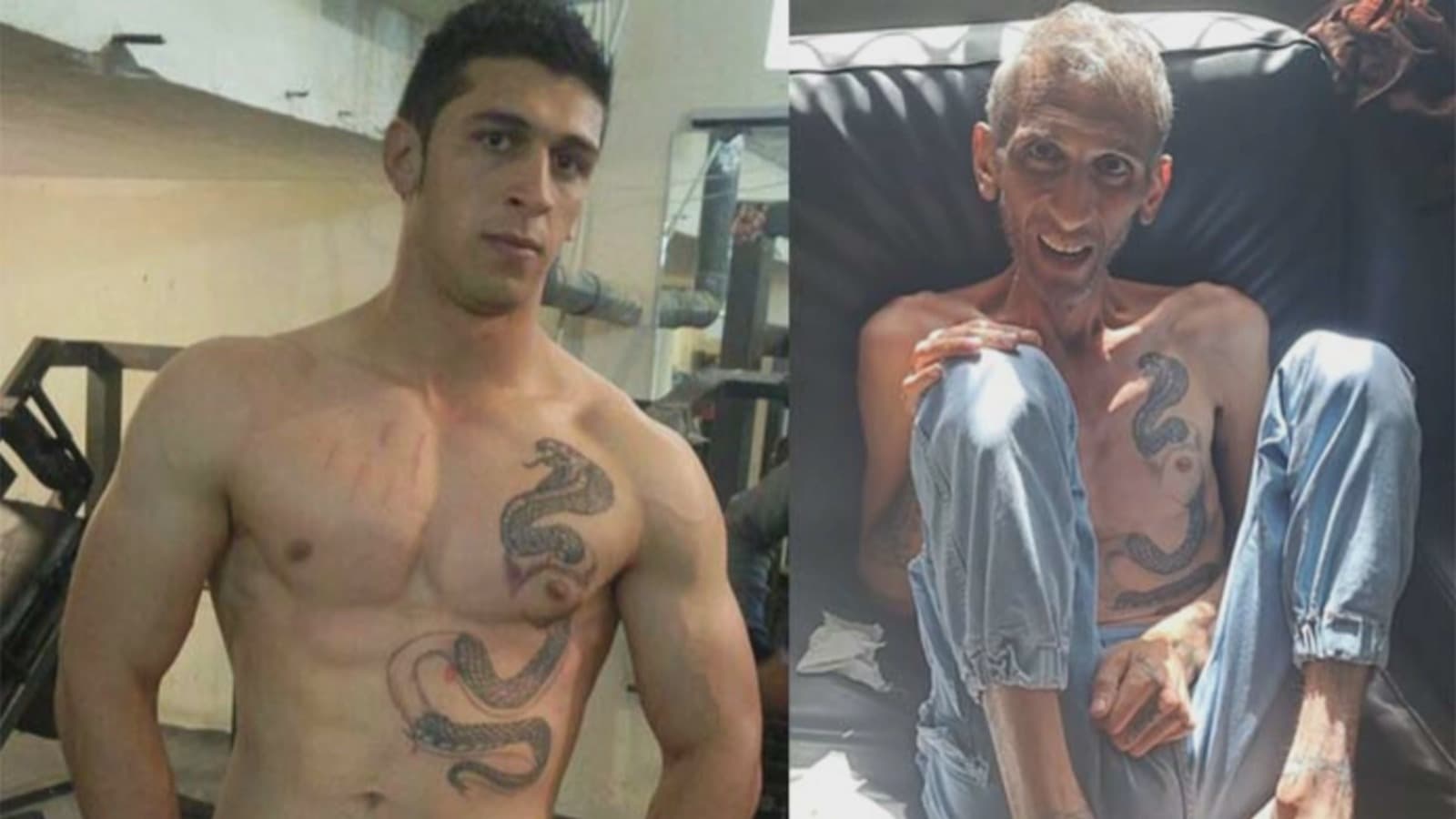 13 yıldır Papua Yeni Gine'de mahsur kalan Kürt mülteci Hatem Yekta ölümün eşiğinde