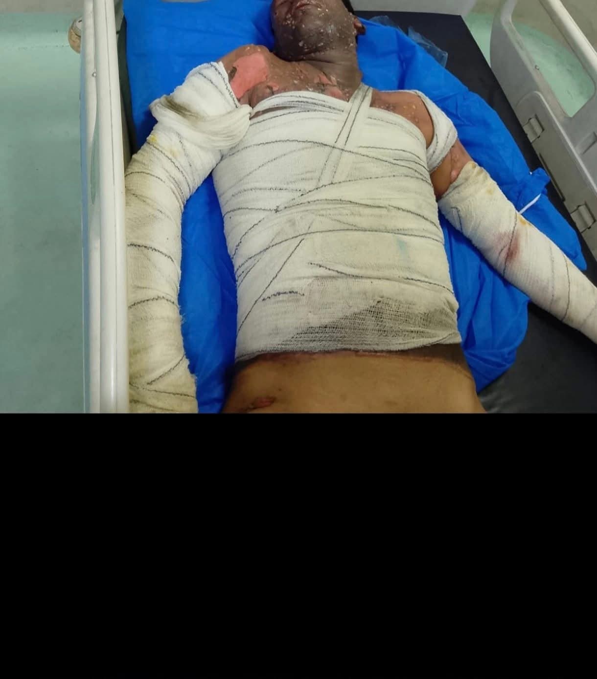 لە دیوانیە گەنجێک لەنێو بنکەی پۆلیسدا خۆی سووتاند