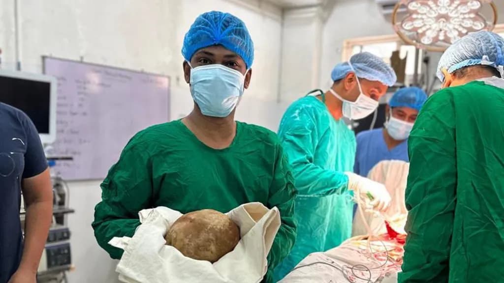 پزیشکانی نەخۆشخانەی گشتیی ترینکۆماڵی لە سریلانکا بەردێکی 3.1 کیلۆگرامیان لە میزڵدانی پیاوێک دەرهێنا