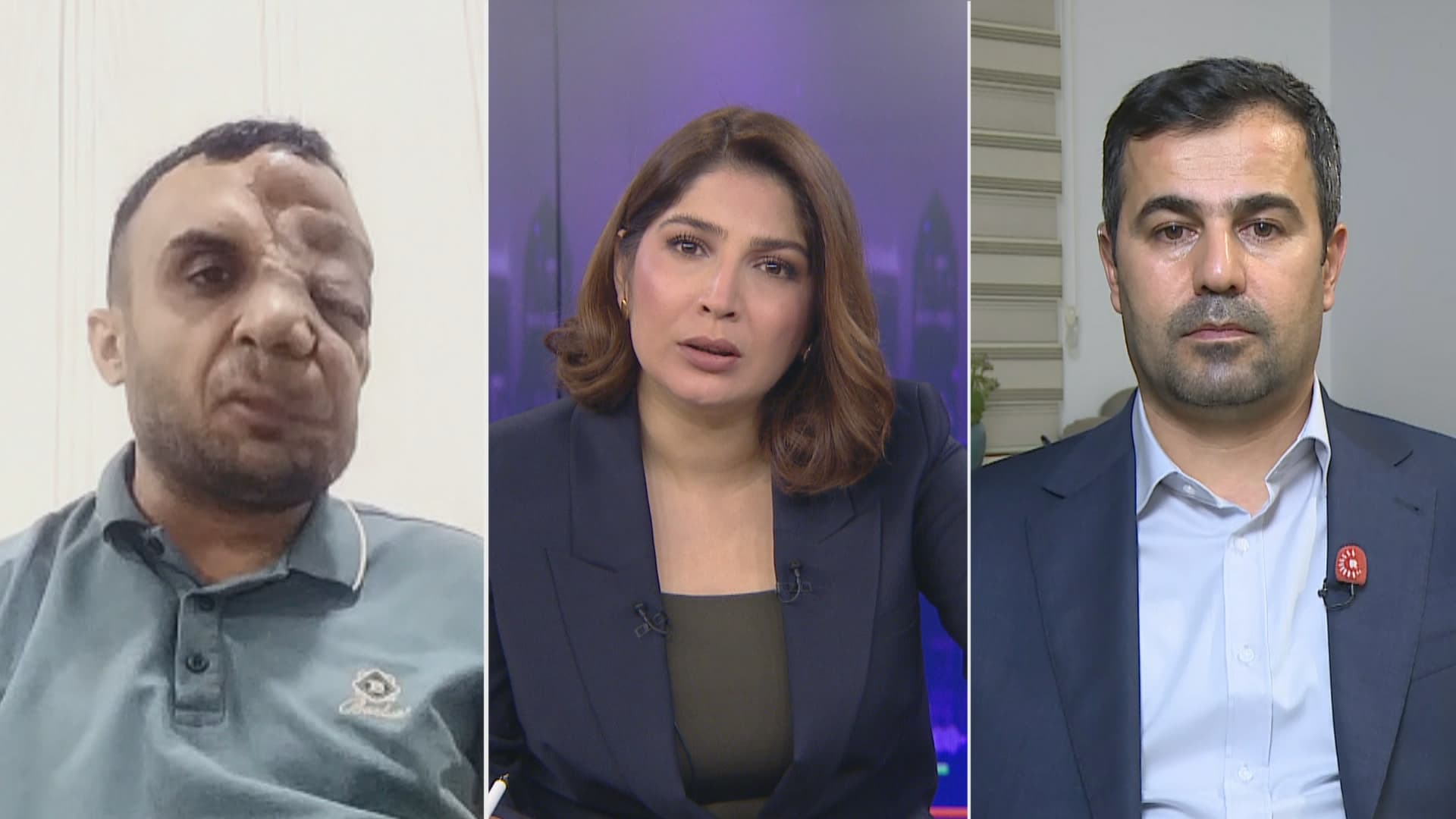 میران ئەحمەد: بەهۆی رووخسارمەوە 4 جار داوای ژنیان رەتکردوومەتەوە
