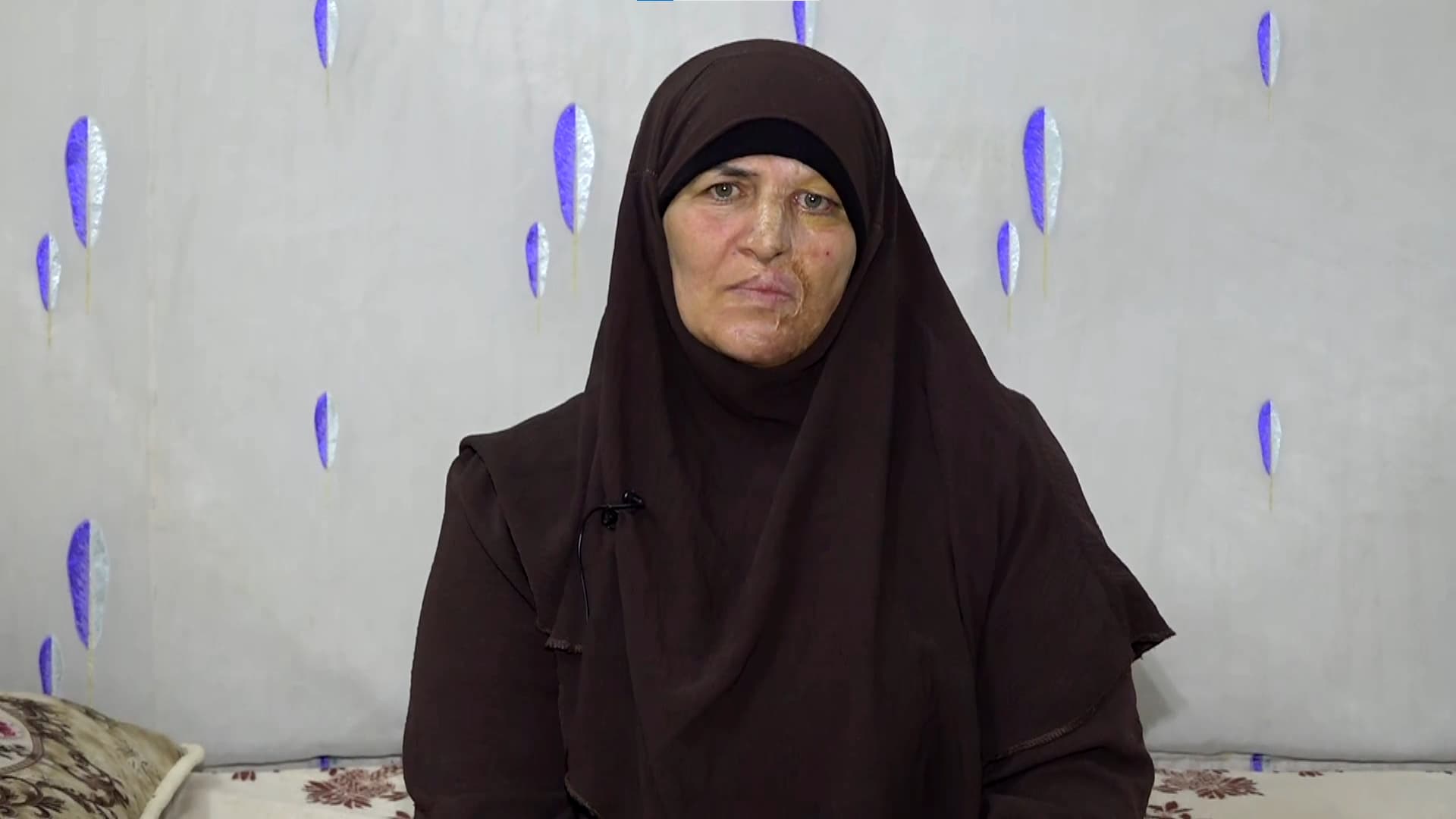 ژنێک لە خەودا بە تێزاب رووخساری دەشێوێندرێت