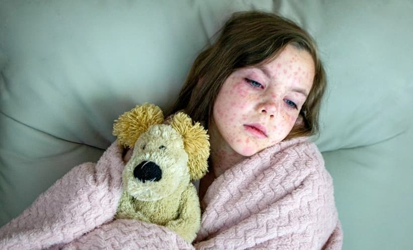 CDC لە ویلایەتی پێنسیلڤانیا پێنج حاڵەتی گیانلەدەستدان بەهۆی سوورێژەوە تۆمار کراون