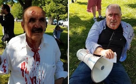 Combo image as published by a Kurdish activist on social media shows some of the protesters injured during the fist fight that broke outside the Turkish embassy in Washington DC.