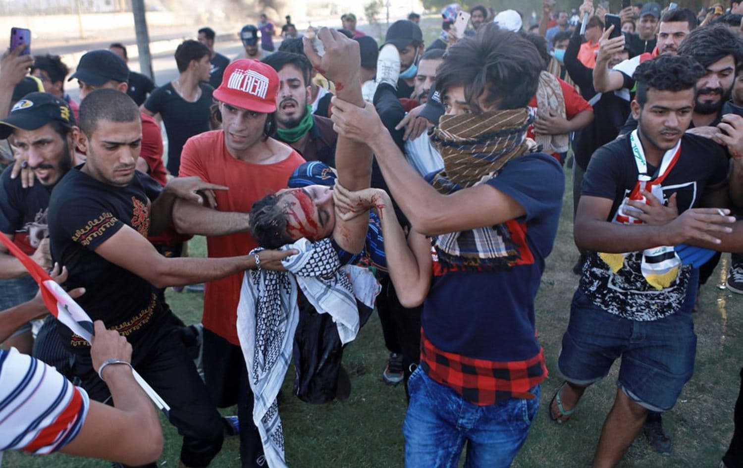 An injured protestor is rushed to hospital after being shot during a demonstration in Baghdad, Iraq, October 4, 2019. Photo: Khalid Mohammed / AP
