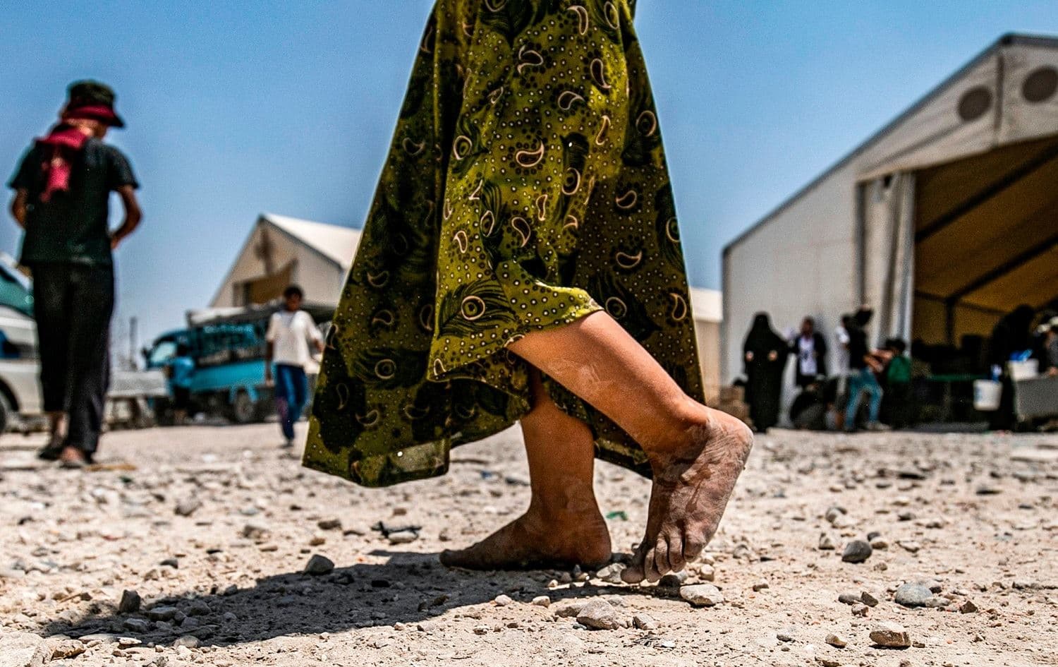 A young child walks barefoot at al-Hol camp in Hasake governorate, northeastern Syria on July 22, 2019. File photo: AFP