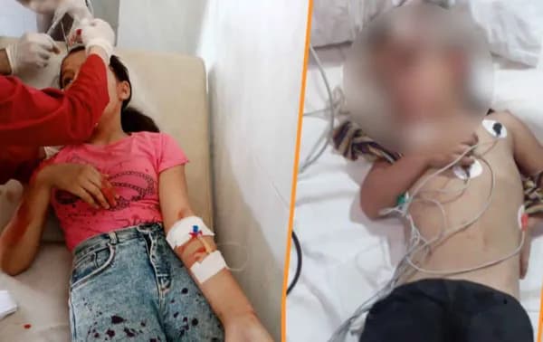 Two of the children who were injured during a suspected Turkish drone attack in Tal Rifaat on August 4, 2022. Photo: SOHR