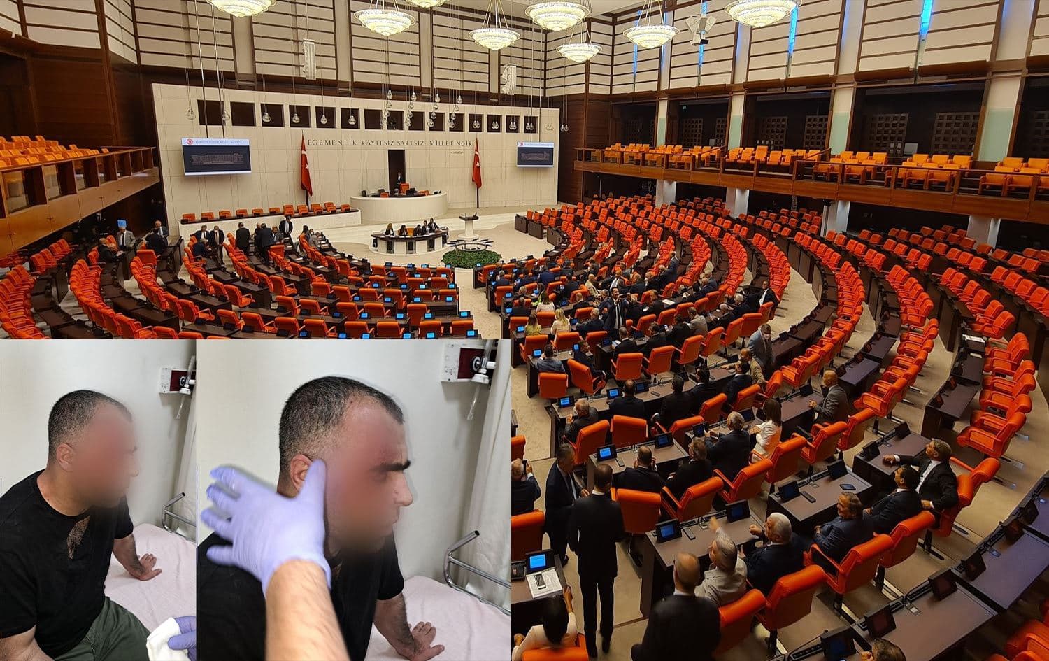Êrîşa li dijî Sînan Aygul li Parlamentoya Tirkiyê bû rojev