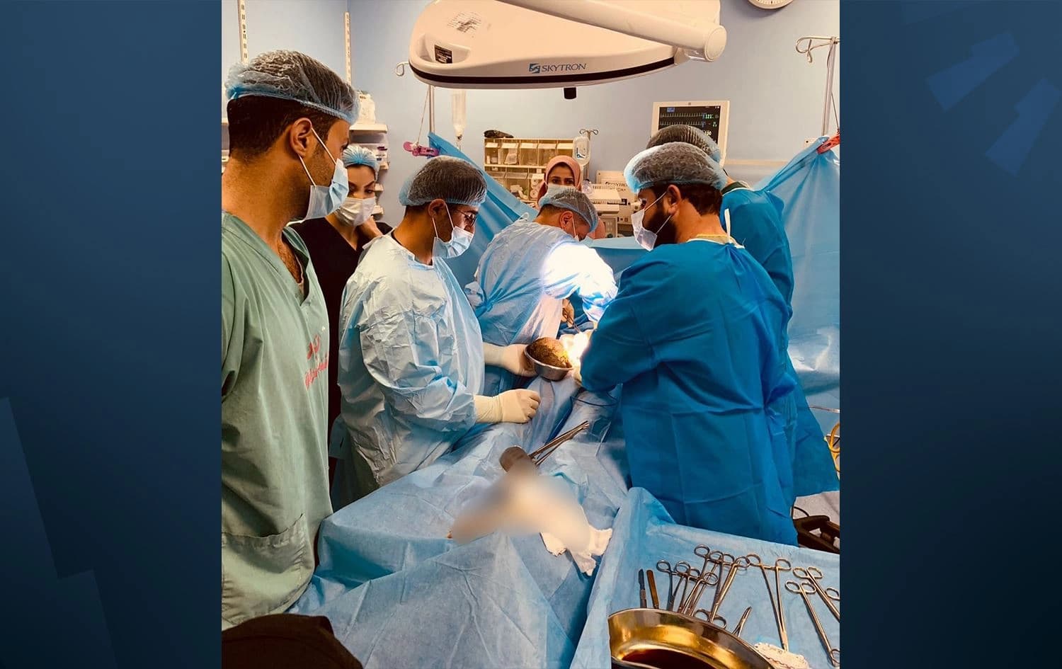 ساتی ئەنجامدانی نەشتەرگەرییەکە.