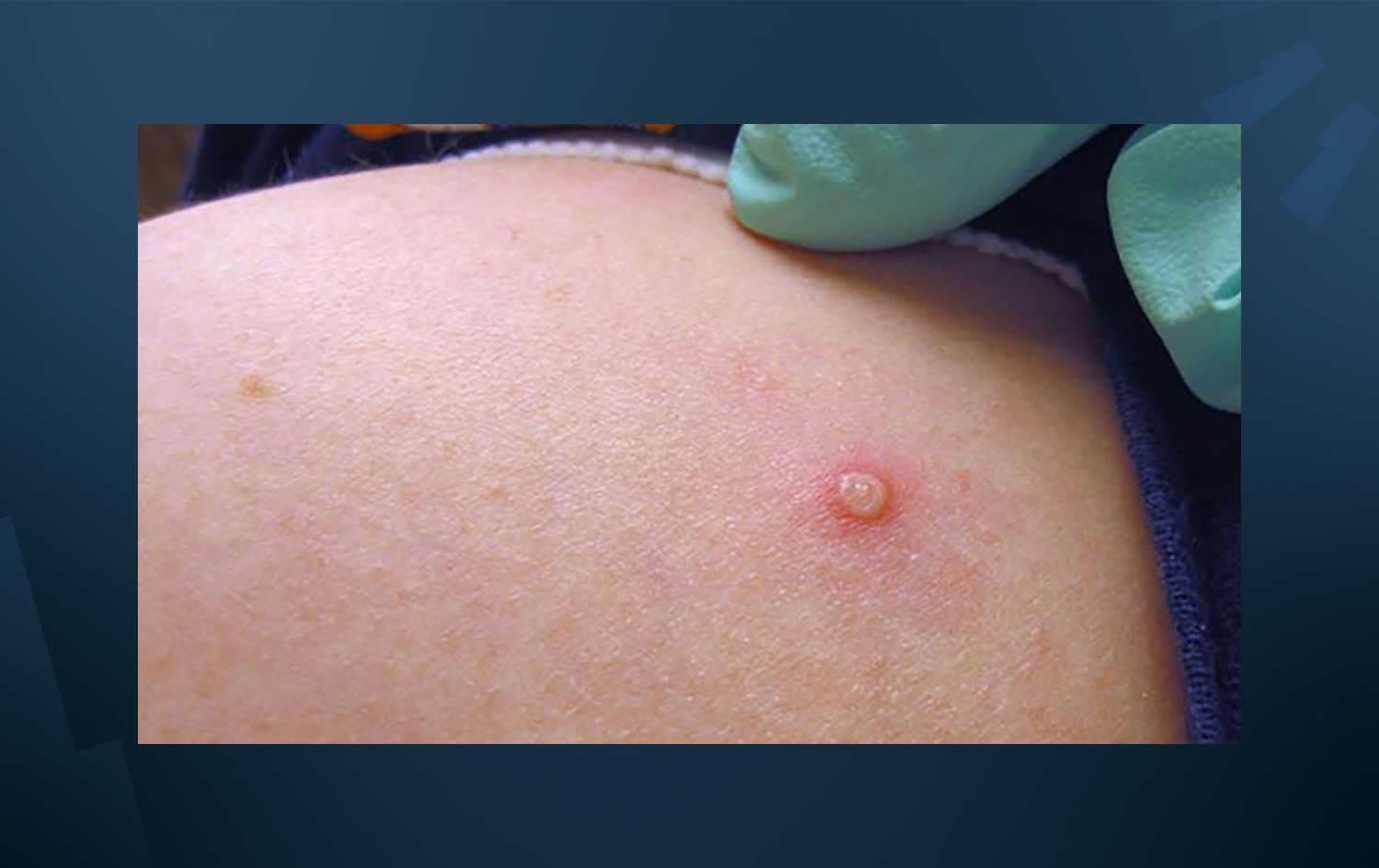 نیشانەیەکی ئاوڵەی مەیموون
