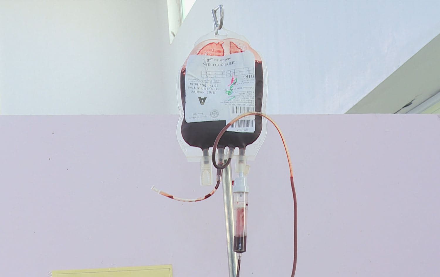 کیسێکی خوێن کە بۆ تووشبووانی تالاسیمیا دادەنرێت بۆ ئەوەی خوێن وەربگرن.
