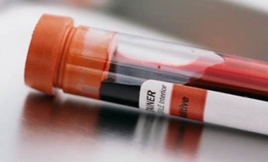 IŞİD’de AIDS salgını