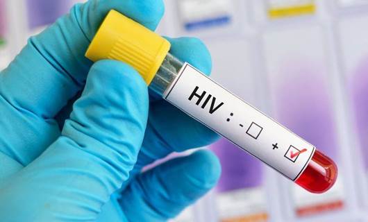 لە کۆنگۆ، بەشێکی هەڵگرانی ڤایرۆسی HIV  بەبێ وەرگرتنی دەرمان چاکبوونەتەوە