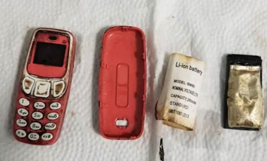 Midesinden Nokia 3310 model cep telefonu çıktı!