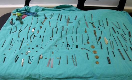 Van'da kadın hastanın midesinden 158 yabancı cisim çıkarıldı